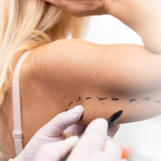 armlift amaryllis clinic plastic surgery abu dhabi