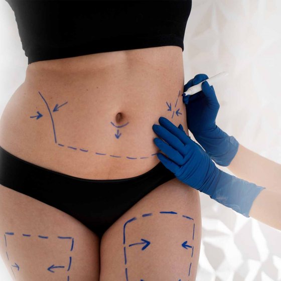 body sculpting surgery dr. chris reuter german plastic surgeon in abu dhabi 2