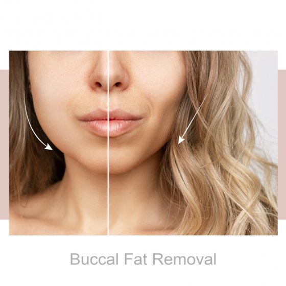 buccal fat removal amaryllis clinic plastic surgery abu dhabi