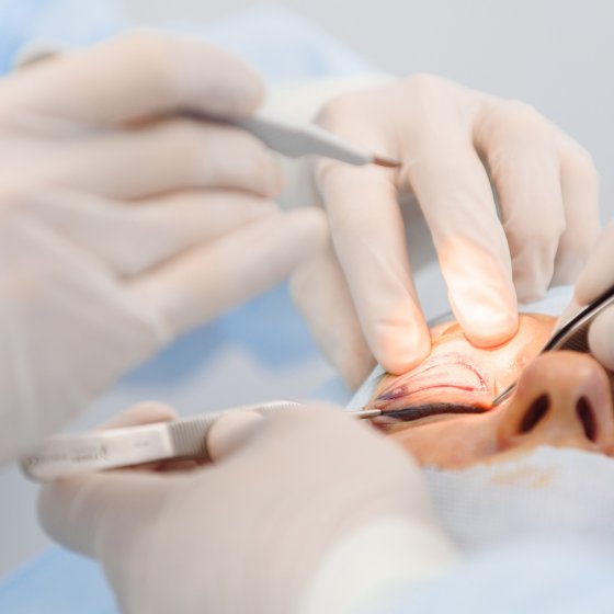 eyelid surgery blepharoplasty amaryllis clinic plastic surgery abu dhabi