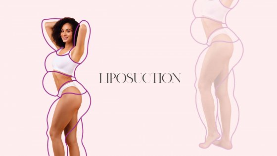 liposuction amaryllis clinic plastic surgery abu dhabi 1