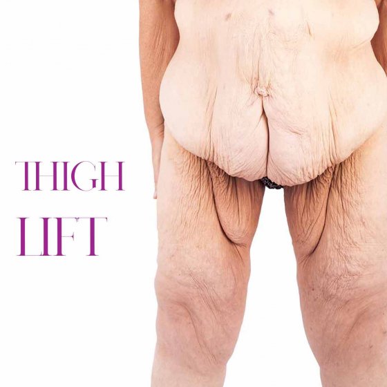 thigh lift amaryllis clinic plastic surgery abu dhabi dr. chris reuter german plastic surgeon