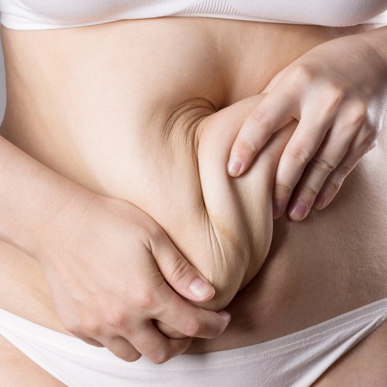 abdominoplasty or tummy tuck amaryllis clinic plastic surgery abu dhabi