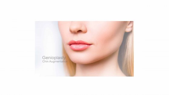  genioplasty amaryllis clinic plastic surgery abu dhabi