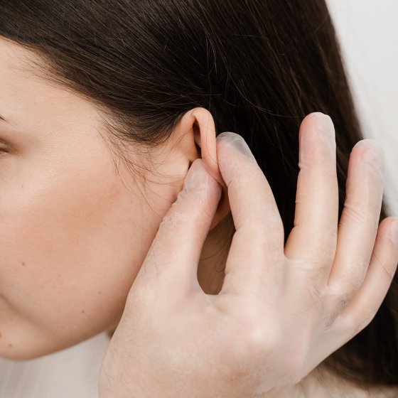 ear correction otoplasty amaryllis clinic plastic surgery best clinic in abu dhabi 1