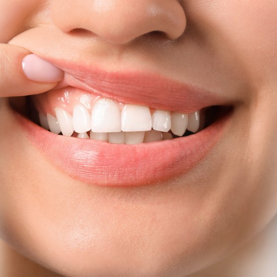 prevention professional prophylaxis design best dental clinic in abu dhabi