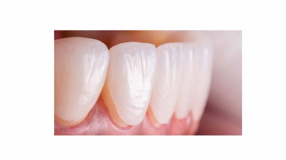 smile design amaryllis german clinic best dental clinic in abu dhabi 2