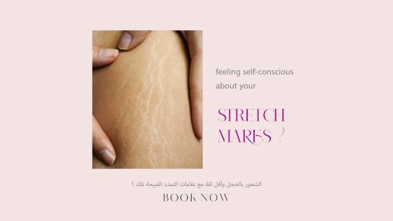 stretch mark removal amaryllis clinic plastic surgery dr. chris reuter german plastic surgeon in abu dhabi