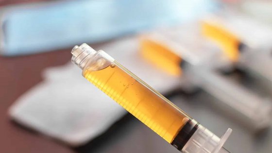 prp plasma amaryllis clinic plastic surgery dr. chris reuter german plastic surgeon in abu dhabi 1